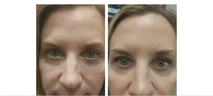 Illuminating Eye