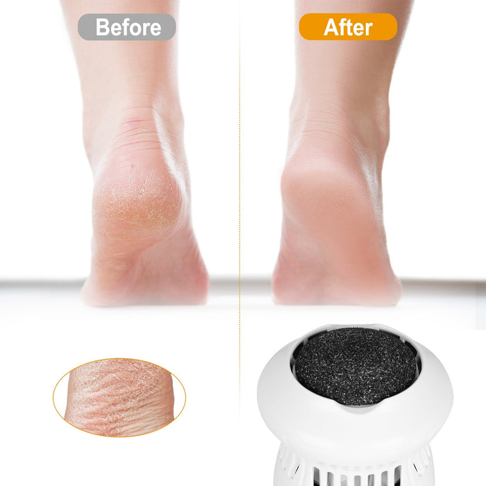 USB Rechargeable Electric Callus Grinder – Vacuum Foot File